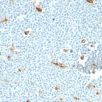 Formalin-fixed, paraffin embedded human tonsil sections stained with 100 ul anti-Macrophage (clone LN-5) at 1:400. HIER epitope retrieval prior to staining was performed in 10mM Citrate, pH 6.0.